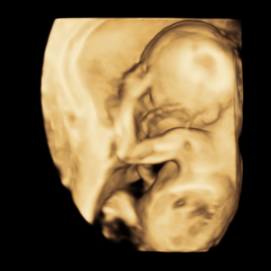 Photo shared by Alyssa for their Babylist baby registry.