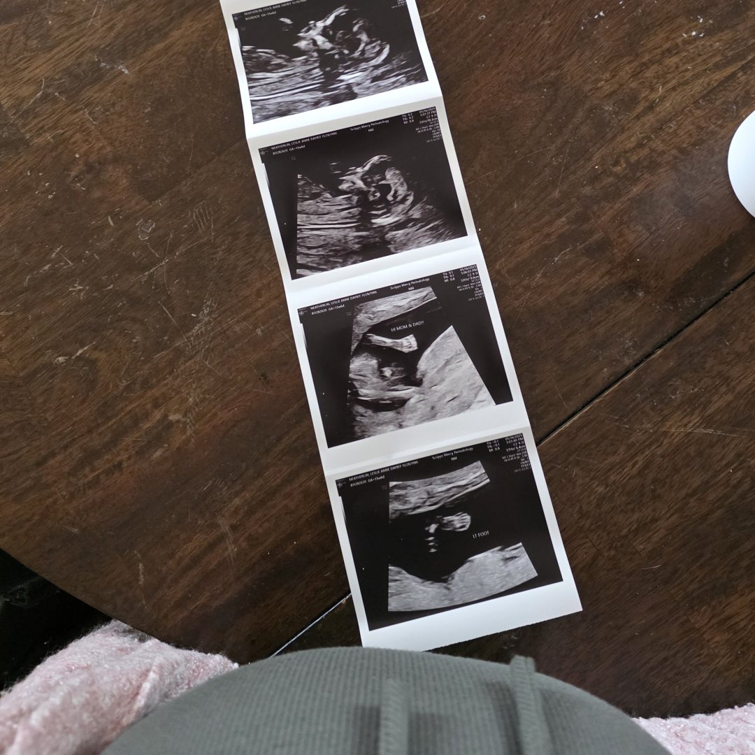 Photo shared by Leslie Anne for their Babylist baby registry.