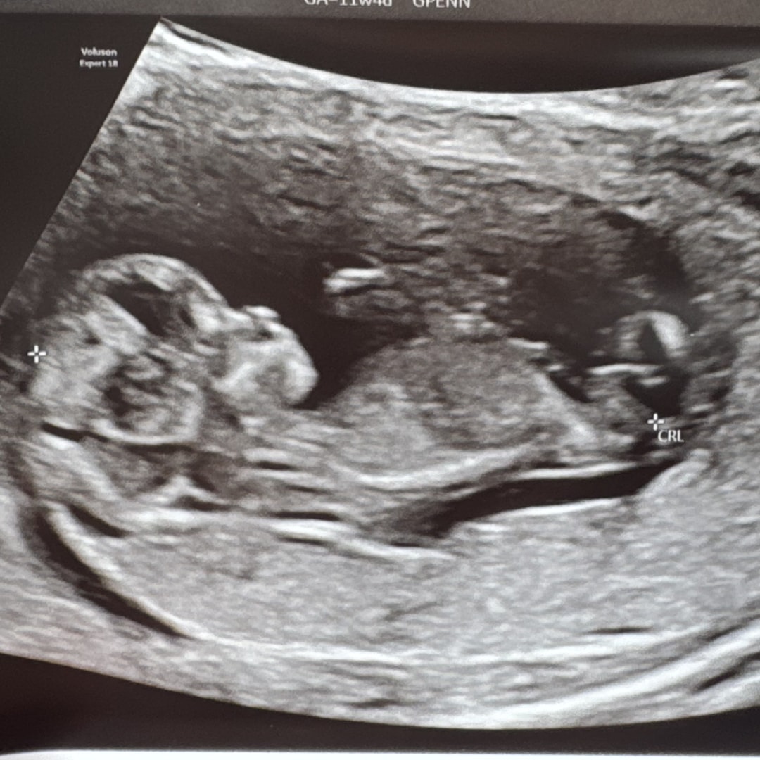 Photo shared by Liliana for their Babylist baby registry.