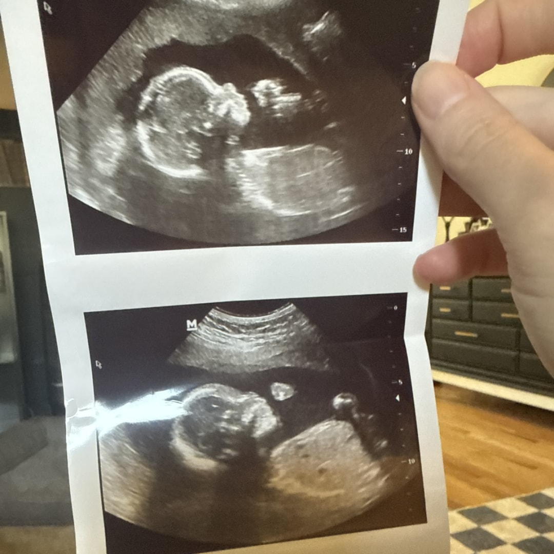 Photo shared by Meagan for their Babylist baby registry.