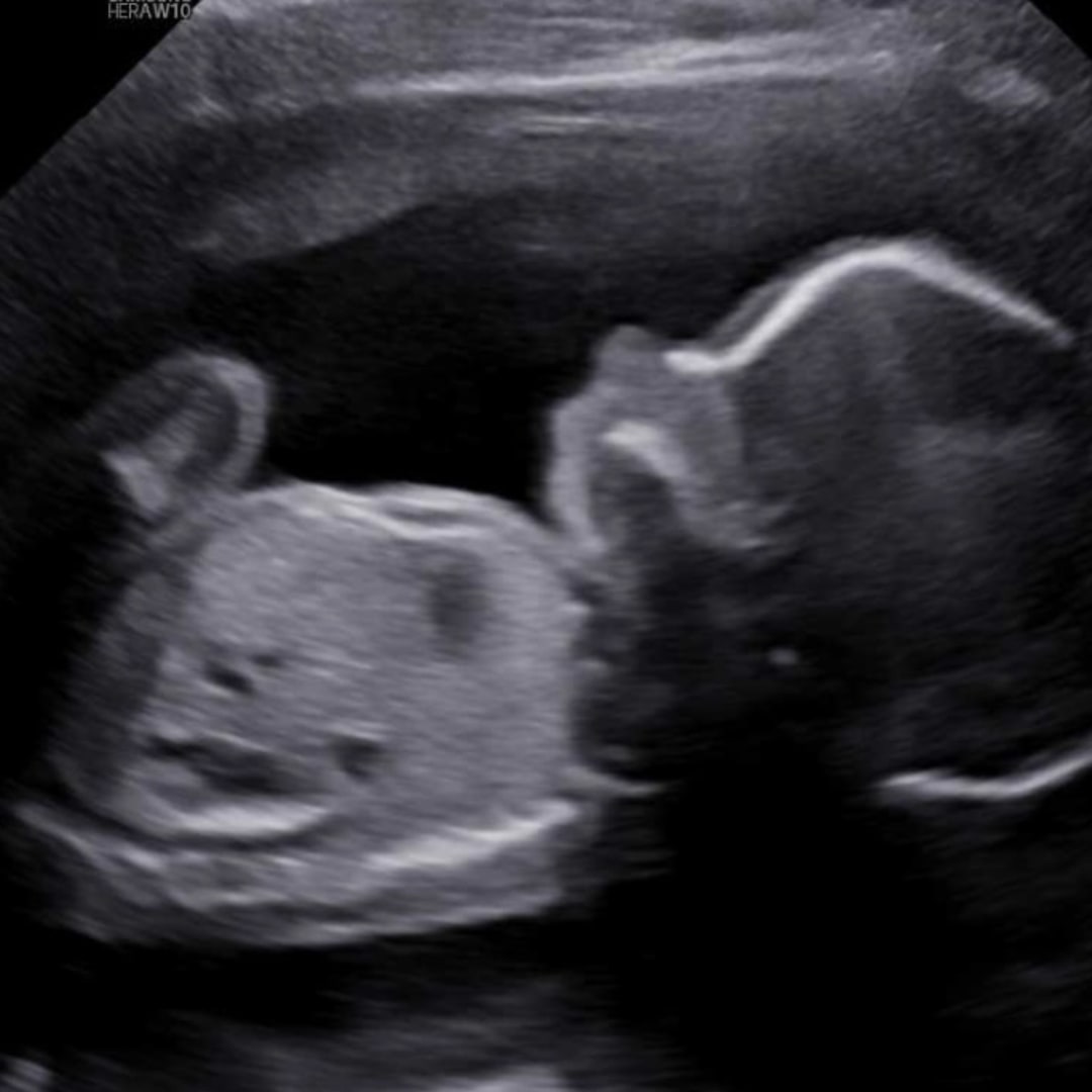 Photo shared by Michelle for their Babylist baby registry.