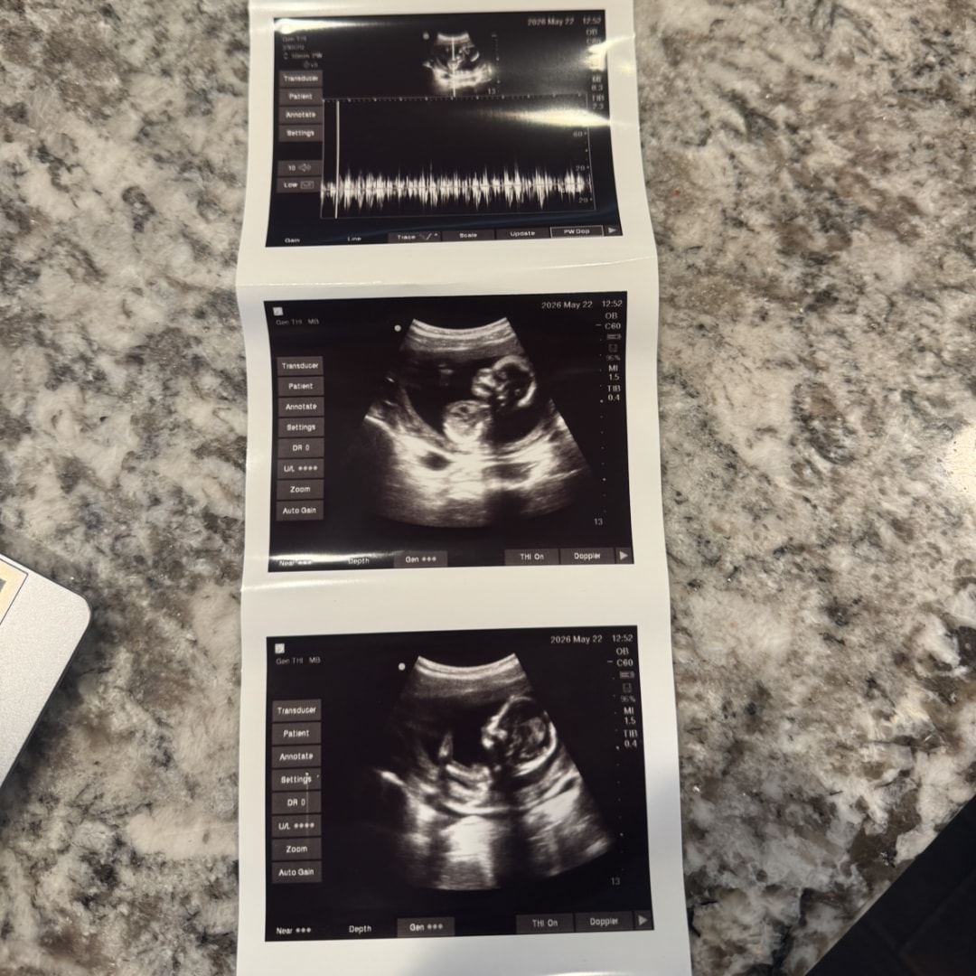 Photo shared by Catie for their Babylist baby registry.