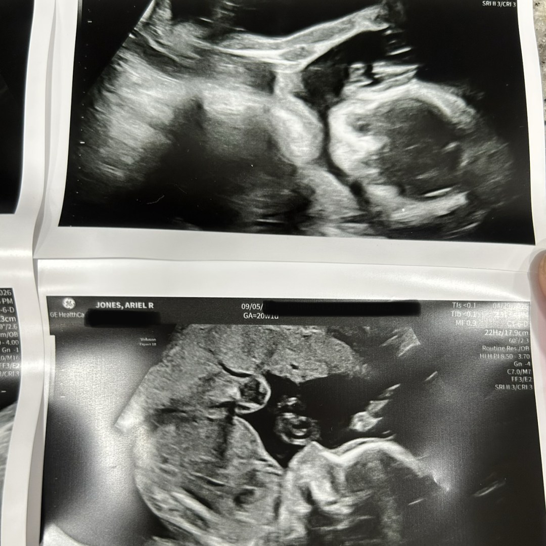 Photo shared by Konnor & Ariel for their Babylist baby registry.