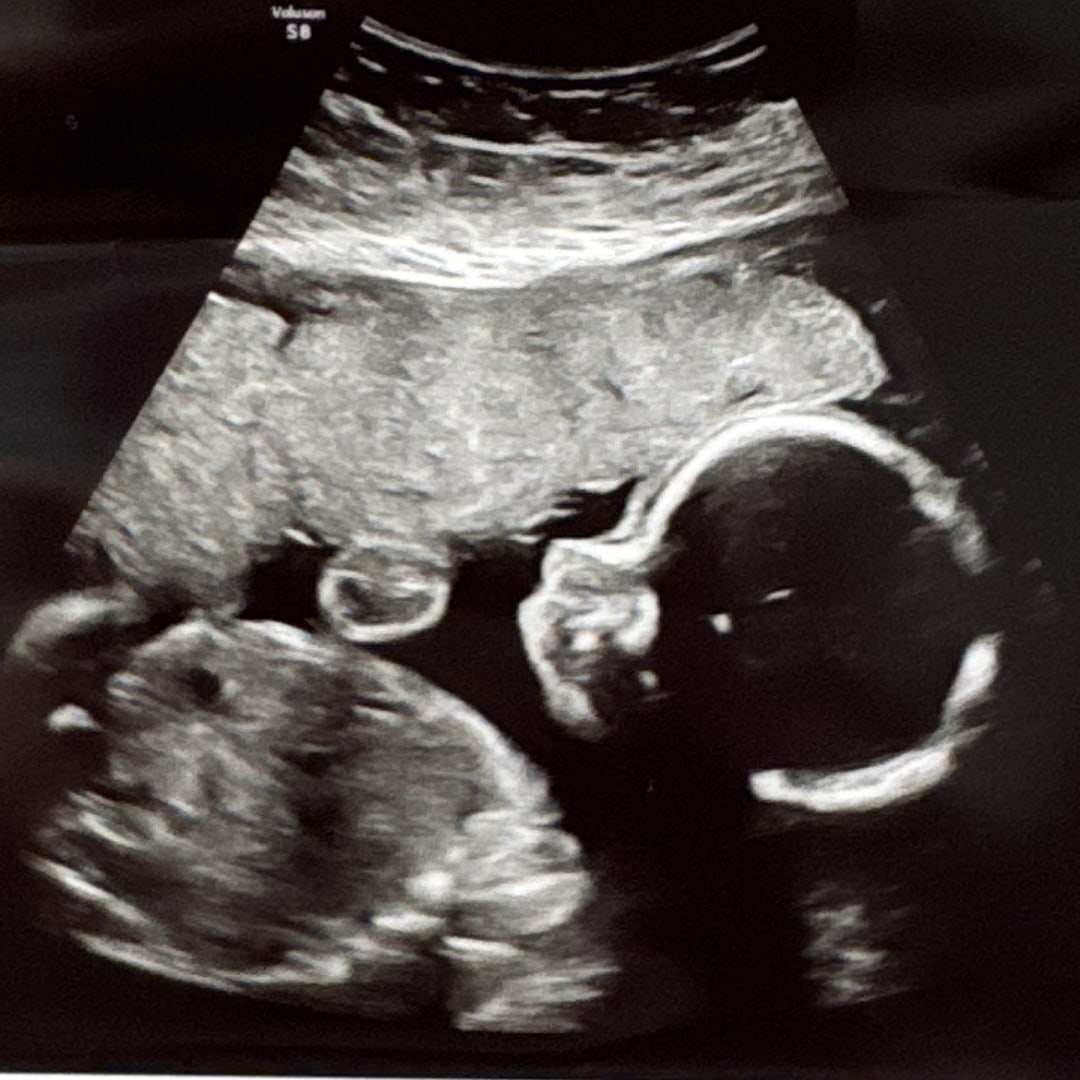 Photo shared by Sarah for their Babylist baby registry.