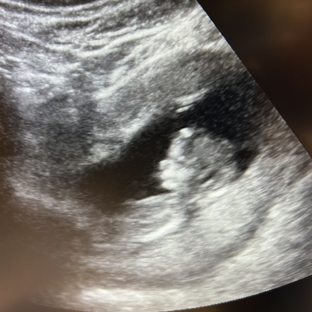 Photo shared by Meghan & Grady for their Babylist baby registry.