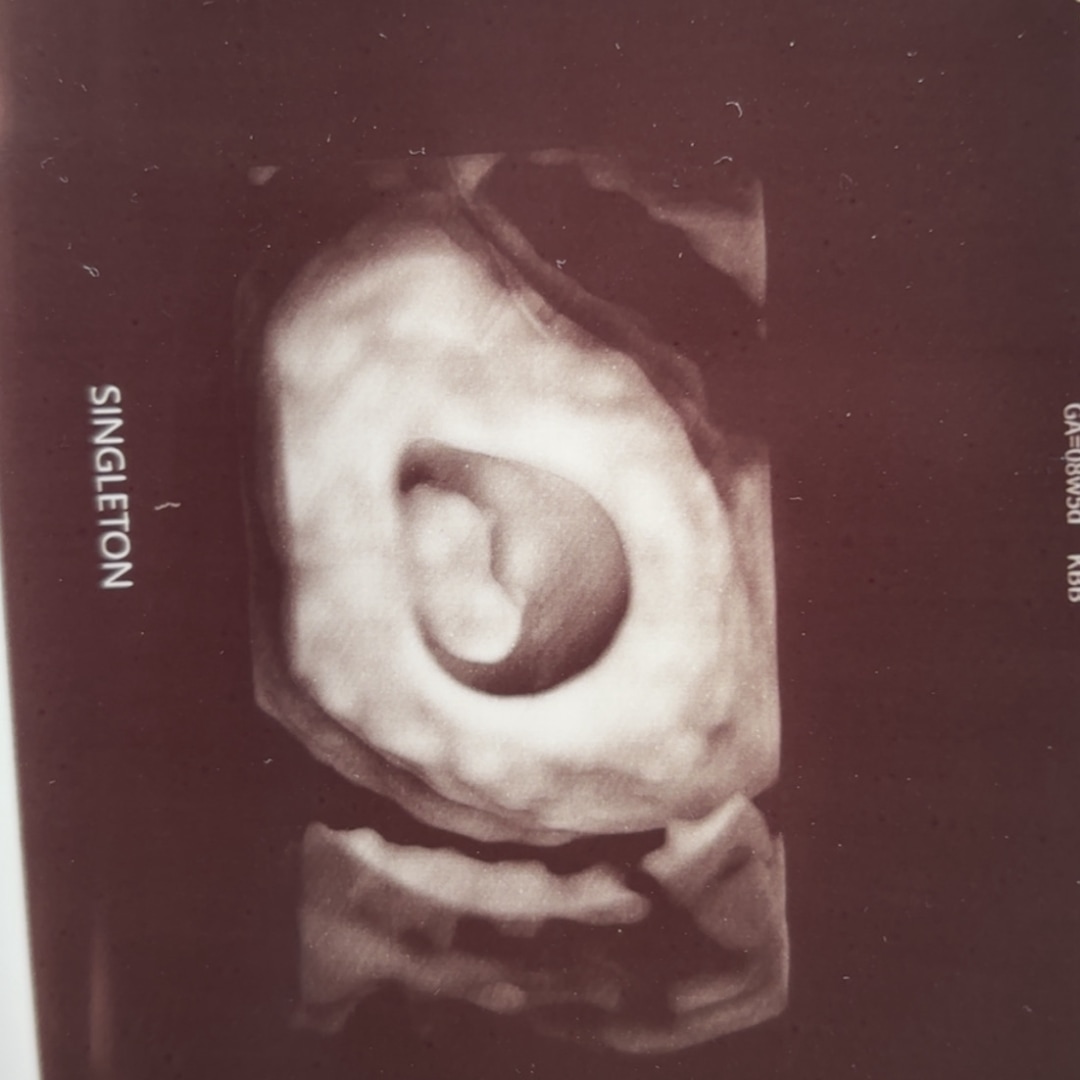Photo shared by Carlie for their Babylist baby registry.