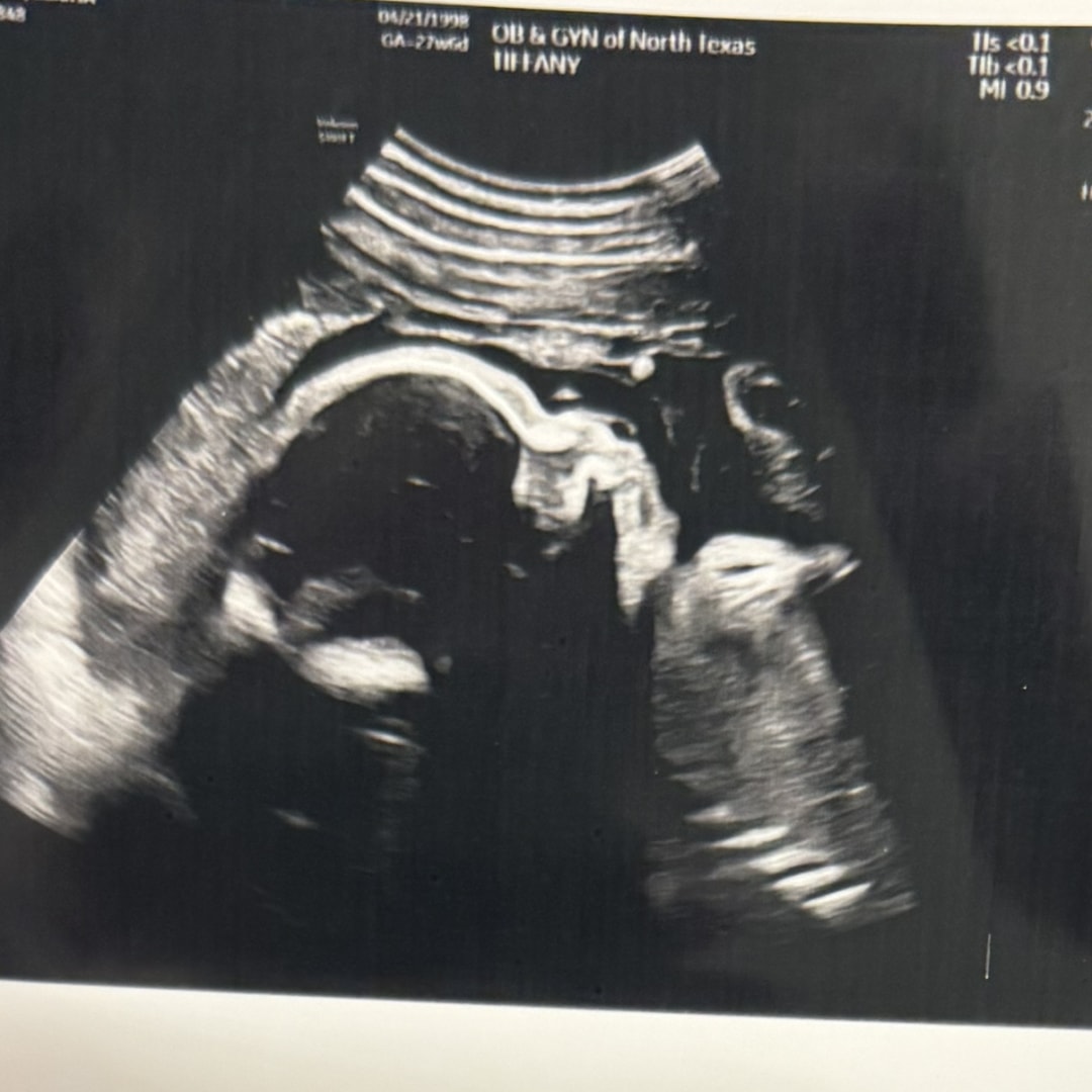 Photo shared by Elisha for their Babylist baby registry.
