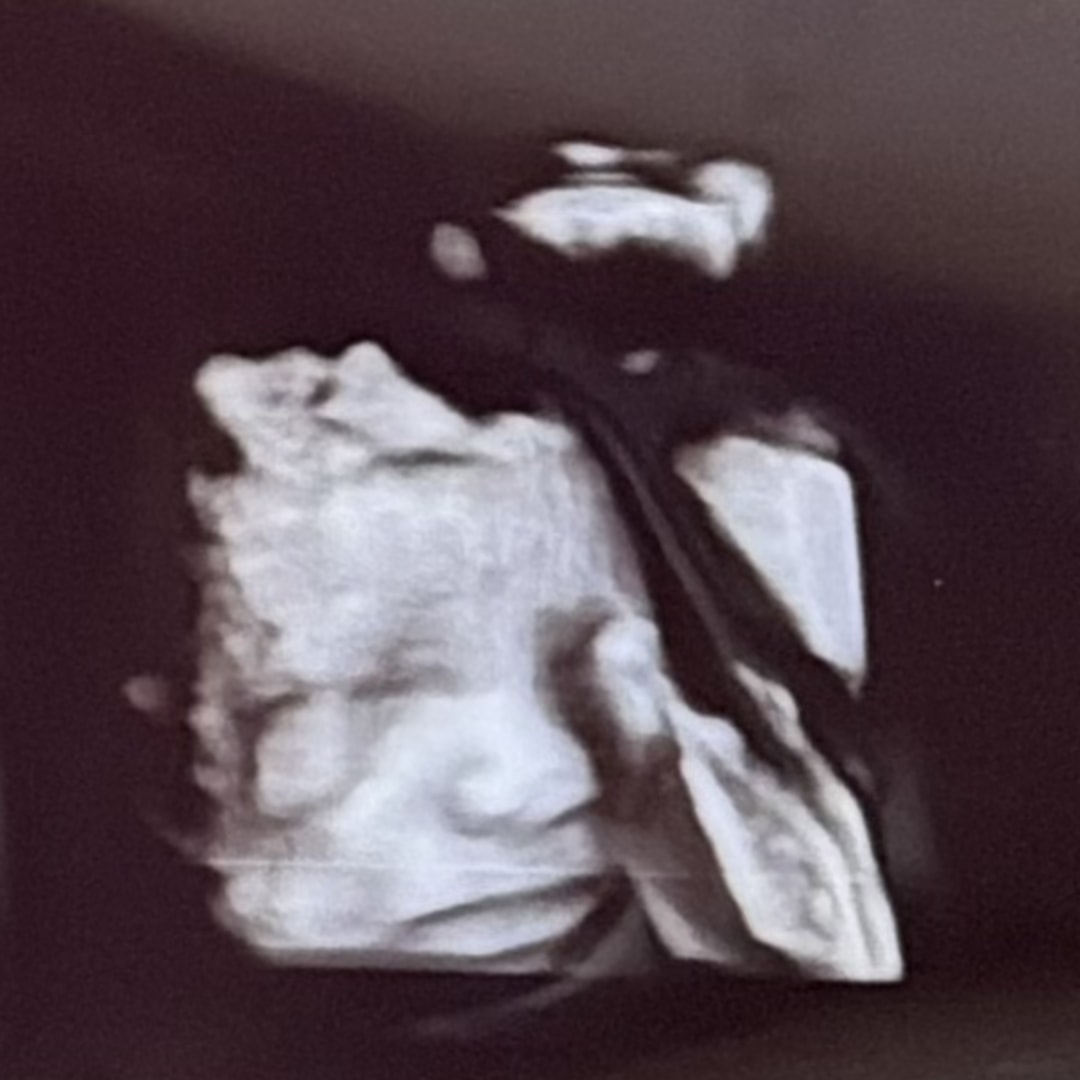 Photo shared by Bella for their Babylist baby registry.