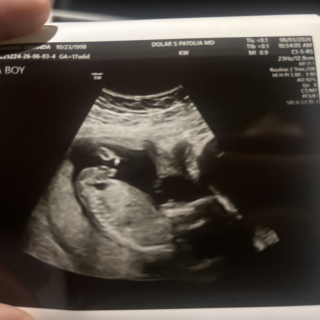 Photo shared by Amanda for their Babylist baby registry.