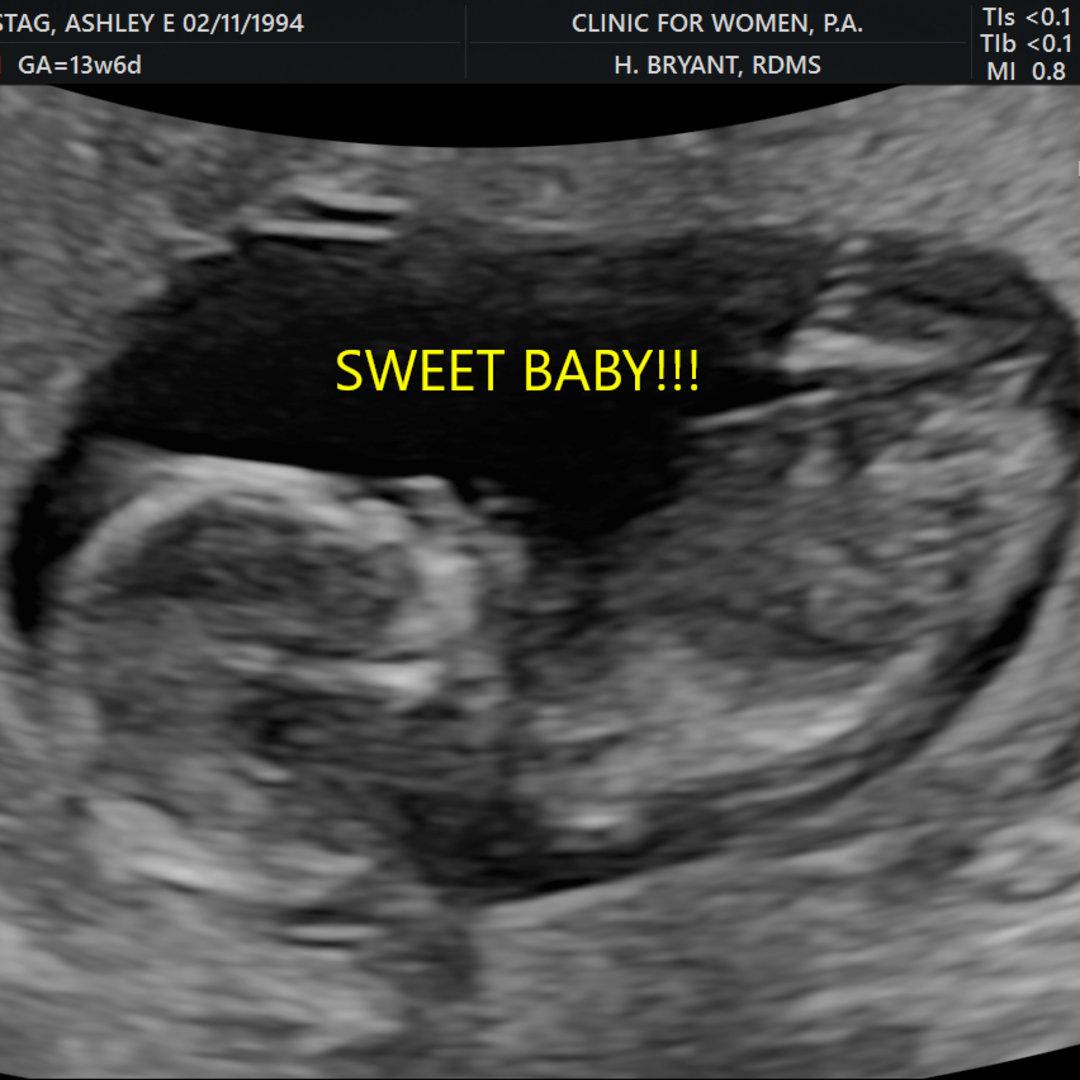 Photo shared by Ashley for their Babylist baby registry.