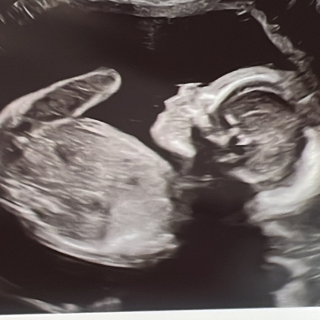 Photo shared by Pamela for their Babylist baby registry.