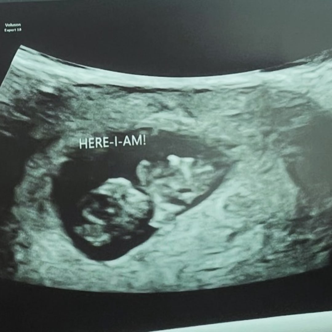 Photo shared by Brianna for their Babylist baby registry.