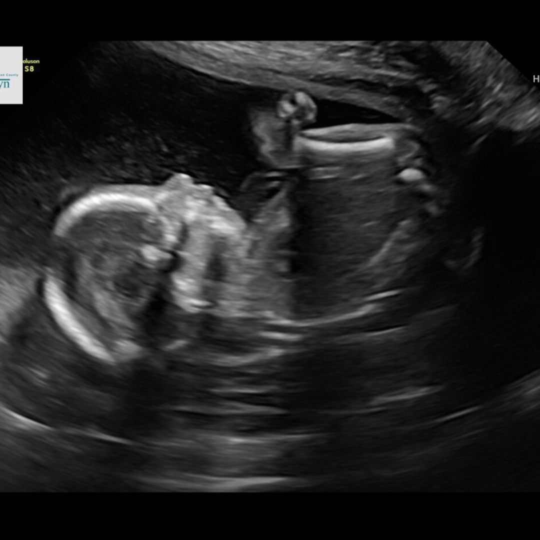 Photo shared by Carley for their Babylist baby registry.