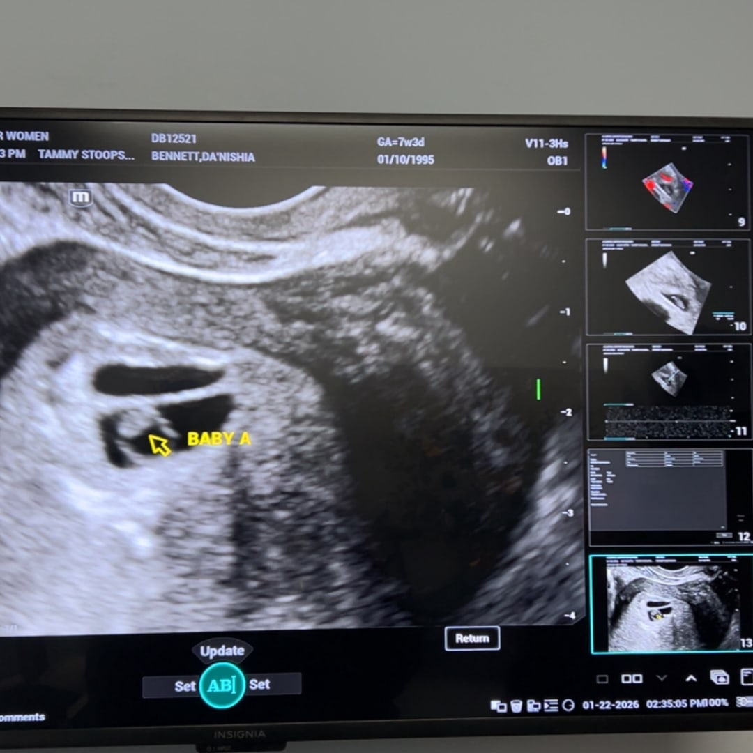 Photo shared by Antonio for their Babylist baby registry.