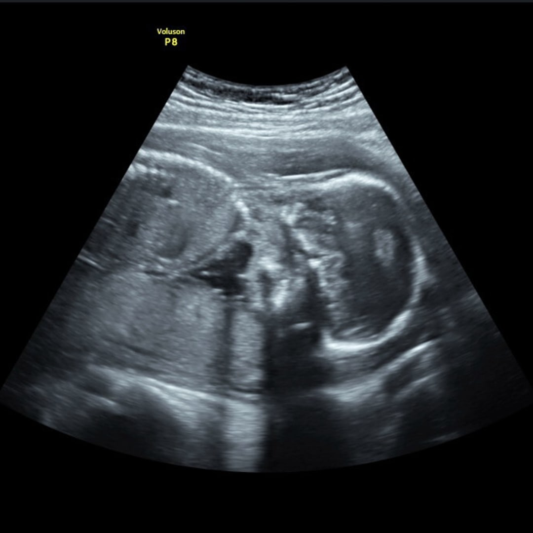 Photo shared by Makenna for their Babylist baby registry.