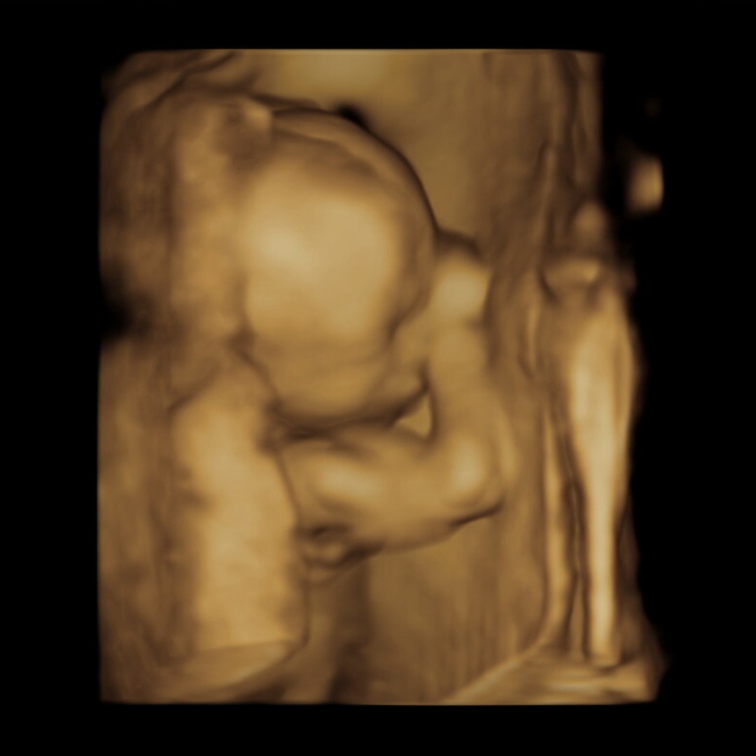 Photo shared by Misty for their Babylist baby registry.