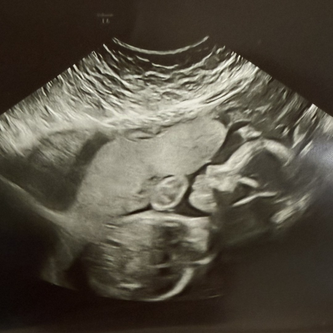 Photo shared by Christin for their Babylist baby registry.