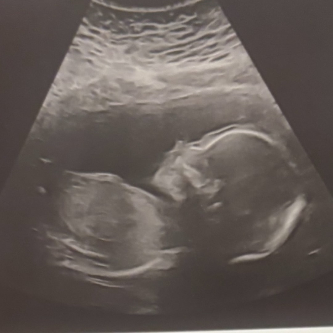 Photo shared by Laura for their Babylist baby registry.