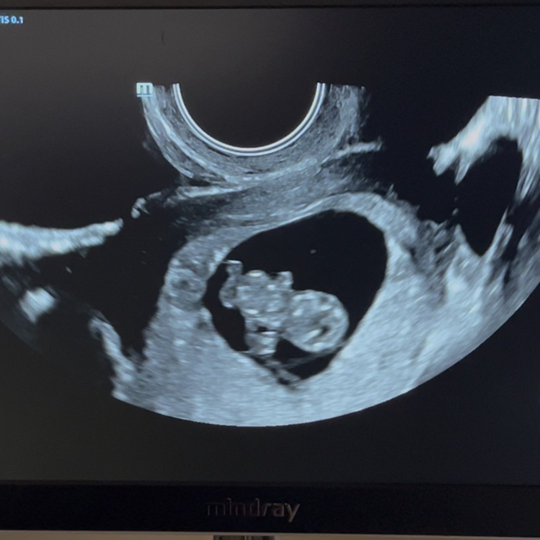 Photo shared by DeAsia for their Babylist baby registry.