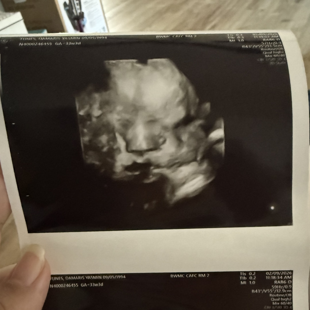 Photo shared by Damaris for their Babylist baby registry.