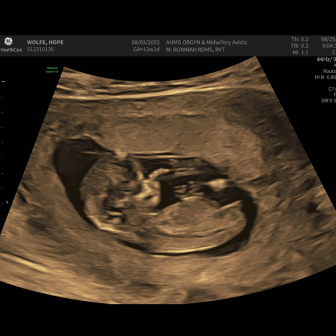 Photo shared by Hope for their Babylist baby registry.