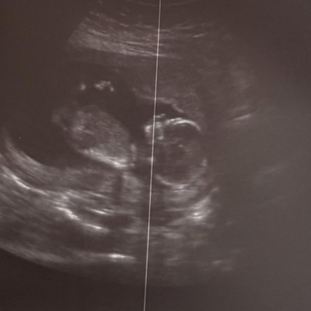 Photo shared by Faviola for their Babylist baby registry.