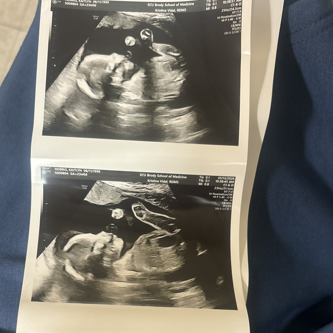 Photo shared by Kaitlyn for their Babylist baby registry.