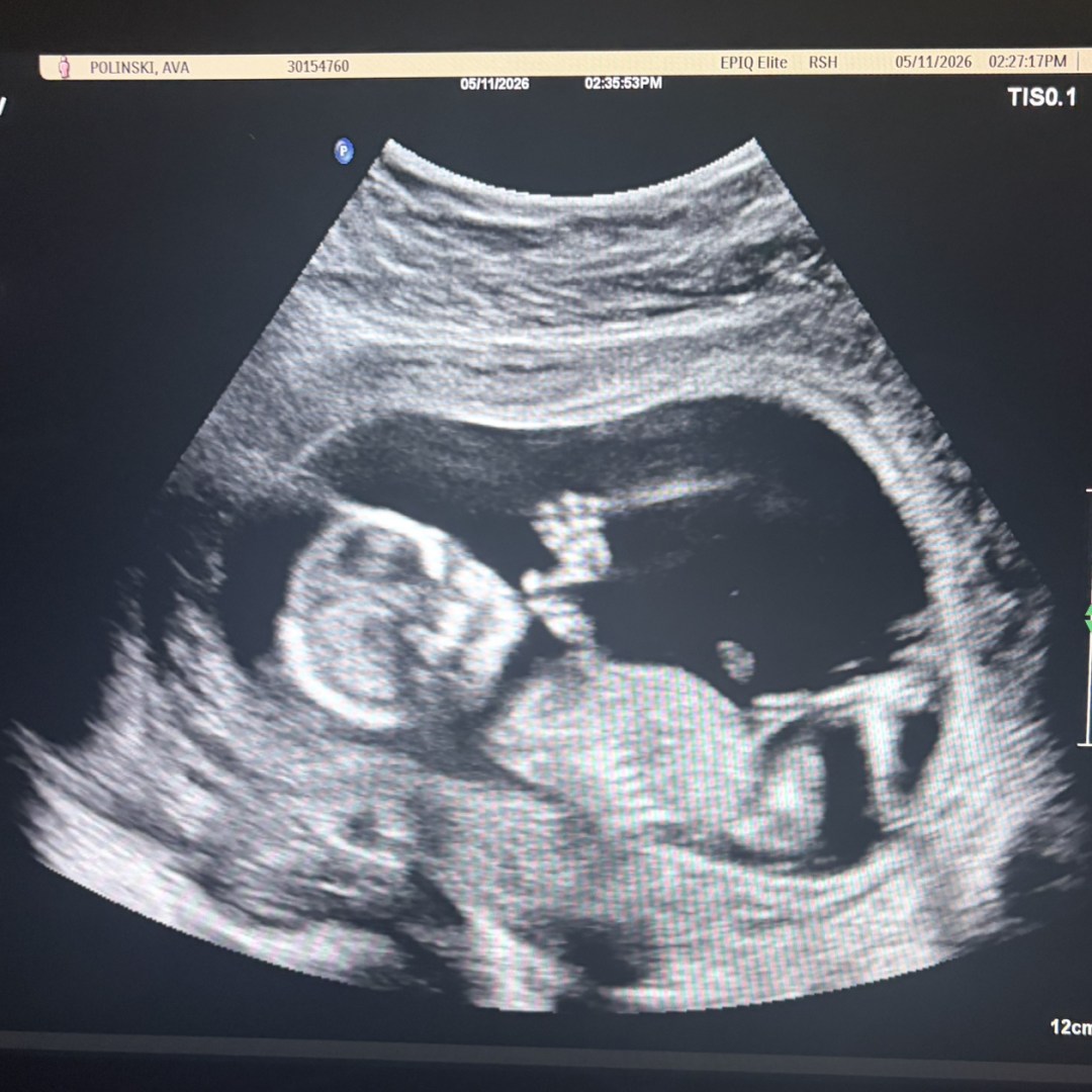 Photo shared by Ava for their Babylist baby registry.