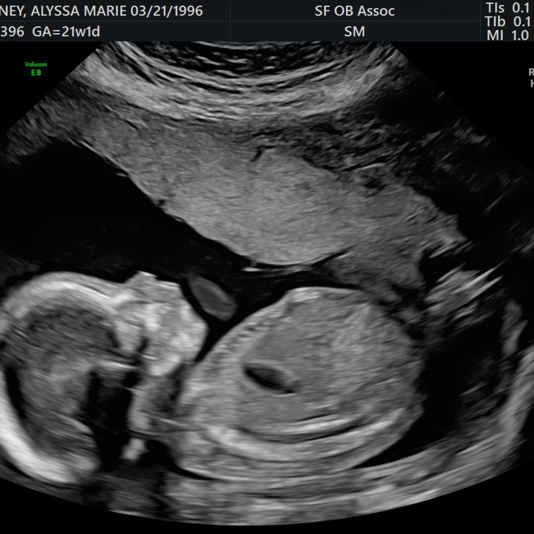 Photo shared by Alyssa for their Babylist baby registry.