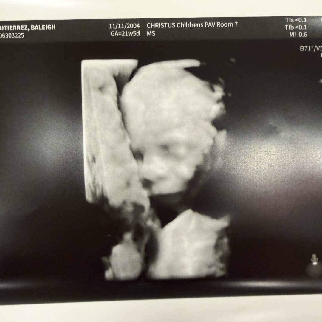 Photo shared by Baleigh for their Babylist baby registry.