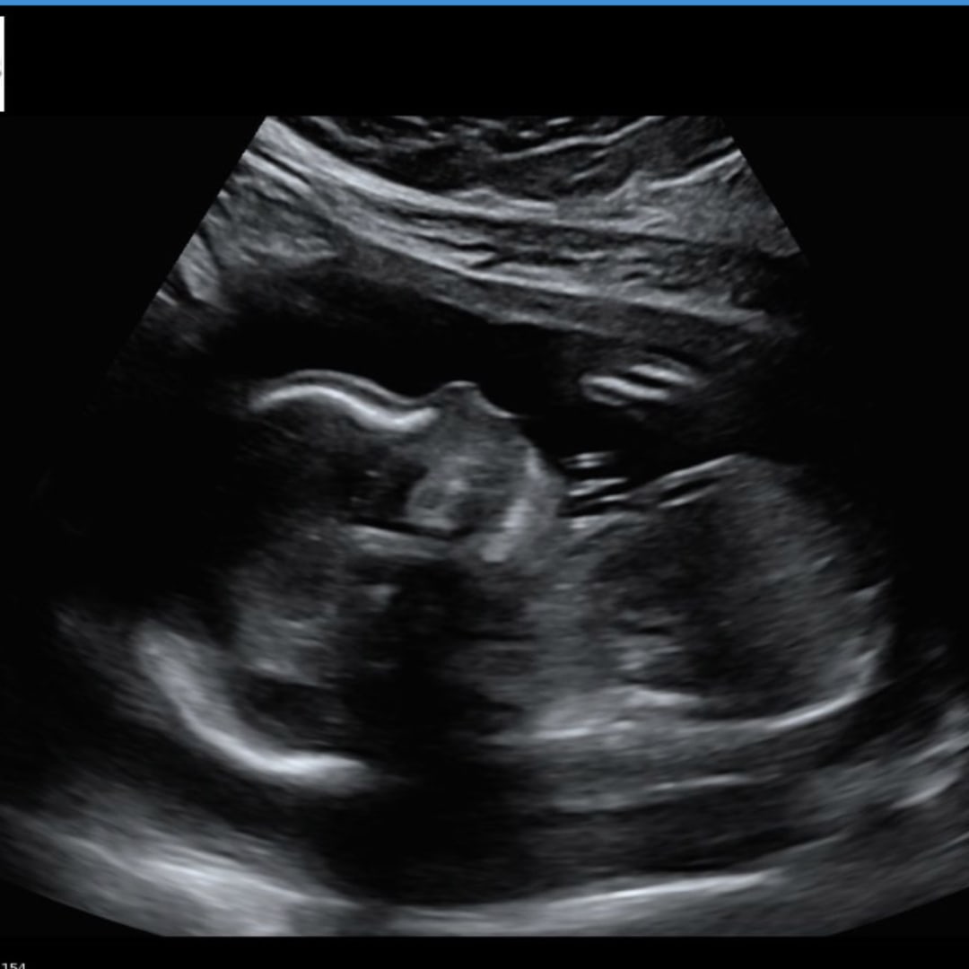 Photo shared by Aalycia for their Babylist baby registry.