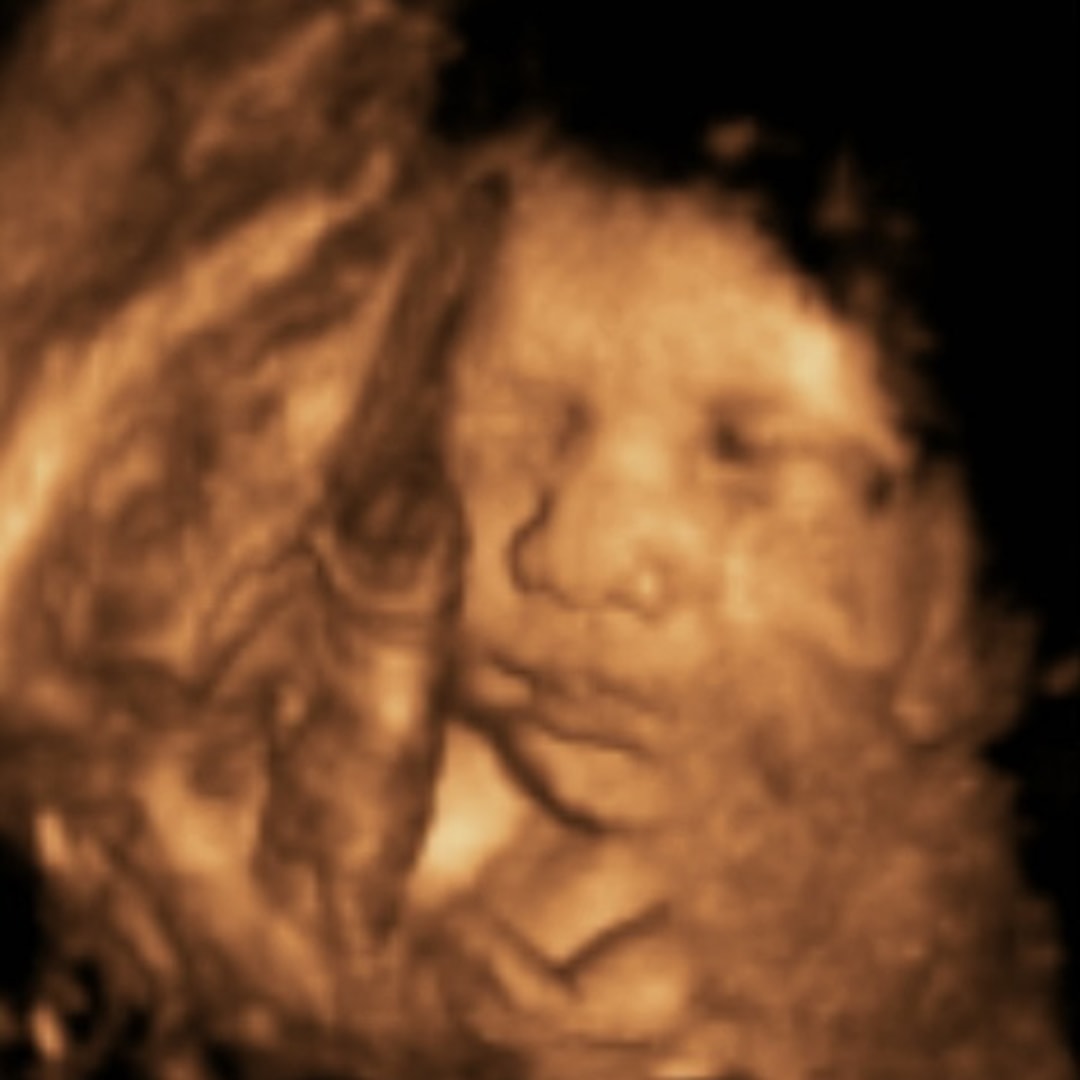 Photo shared by Isabella Raye for their Babylist baby registry.
