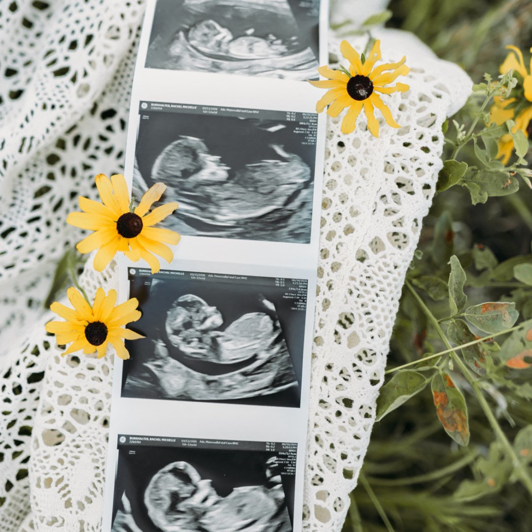 Photo shared by Rachel for their Babylist baby registry.