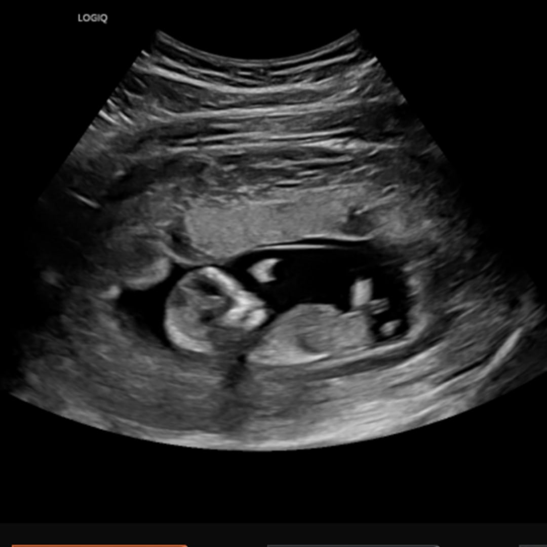 Photo shared by Roxanne for their Babylist baby registry.