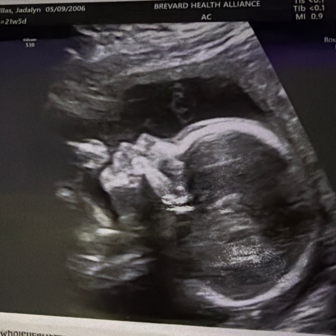 Photo shared by Jadalyn for their Babylist baby registry.