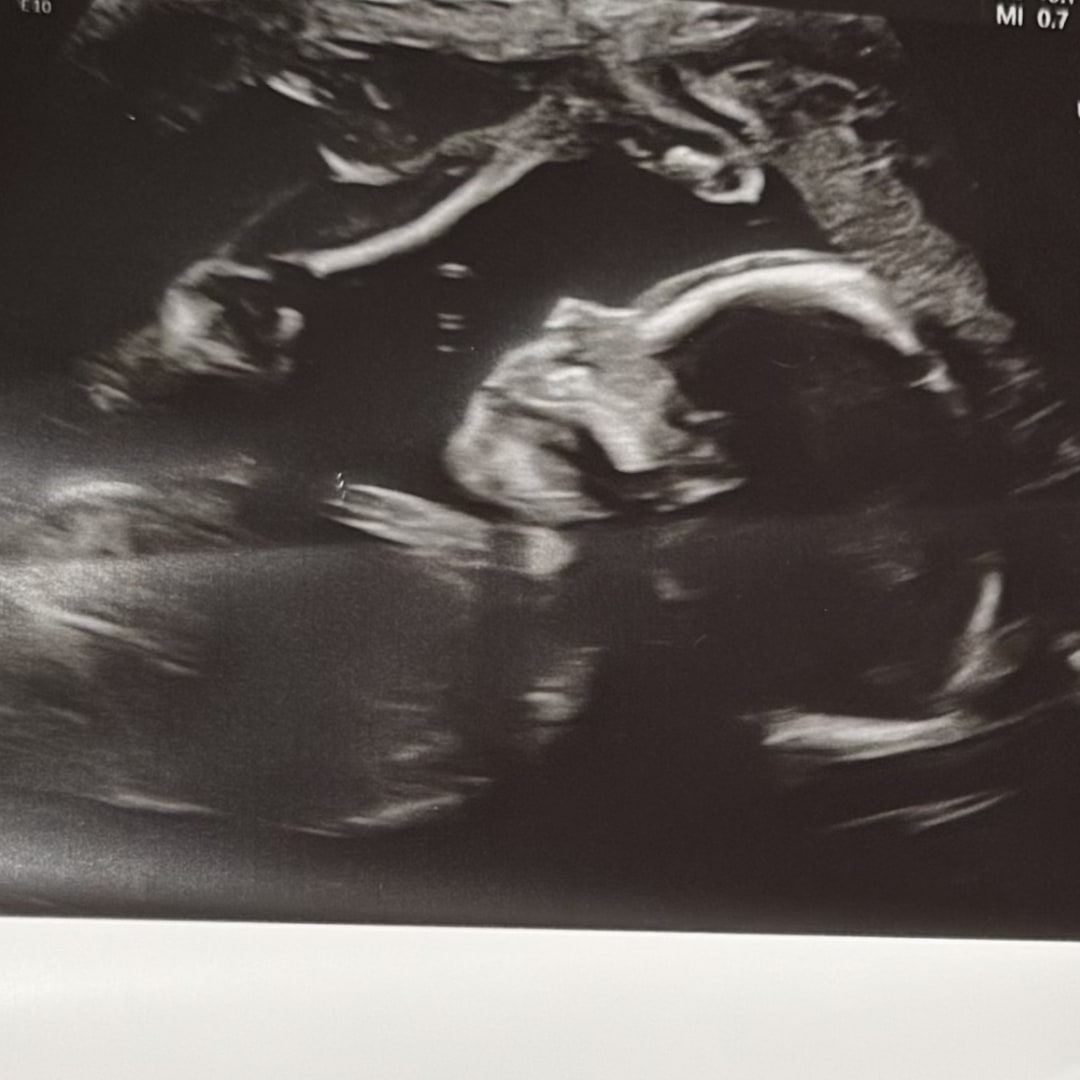 Photo shared by Melinda for their Babylist baby registry.