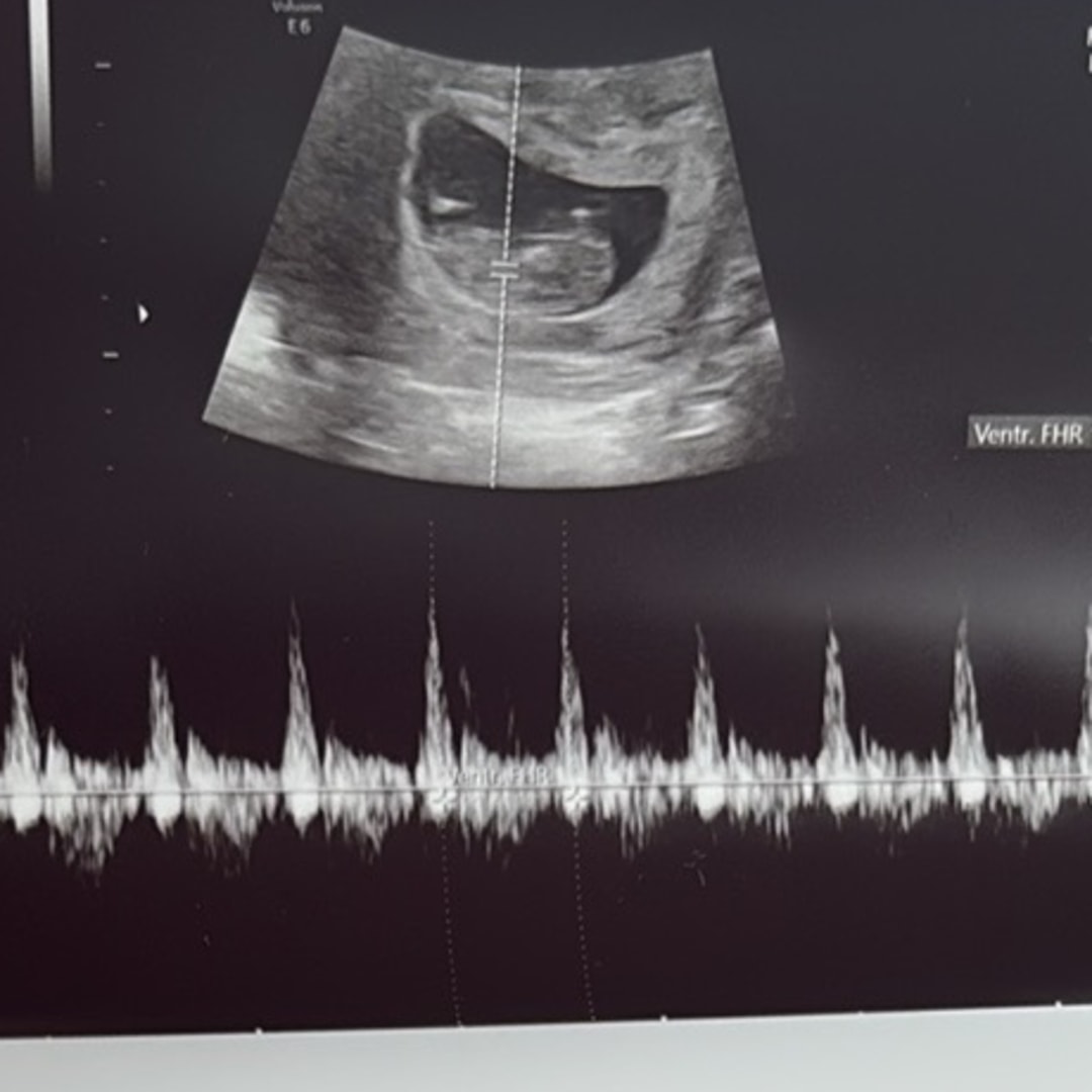 Photo shared by Haley for their Babylist baby registry.