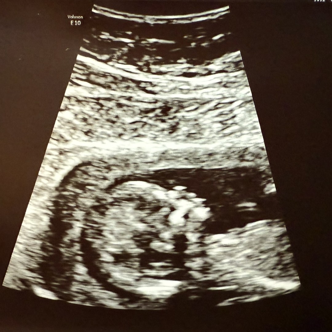 Photo shared by Breanna for their Babylist baby registry.