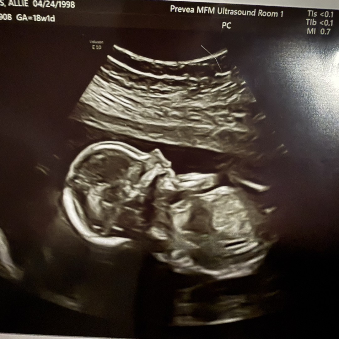 Photo shared by Allie for their Babylist baby registry.