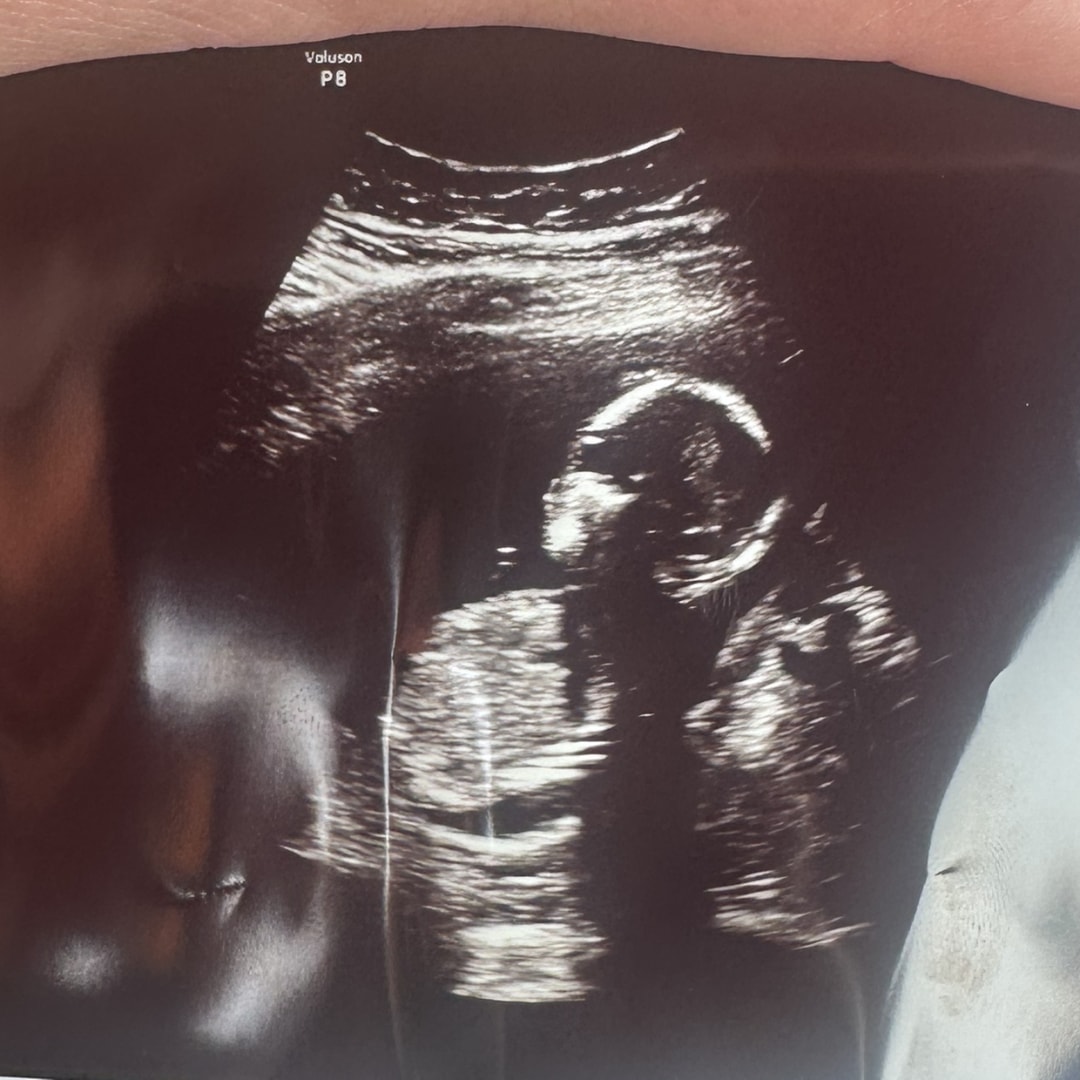 Photo shared by Emily for their Babylist baby registry.