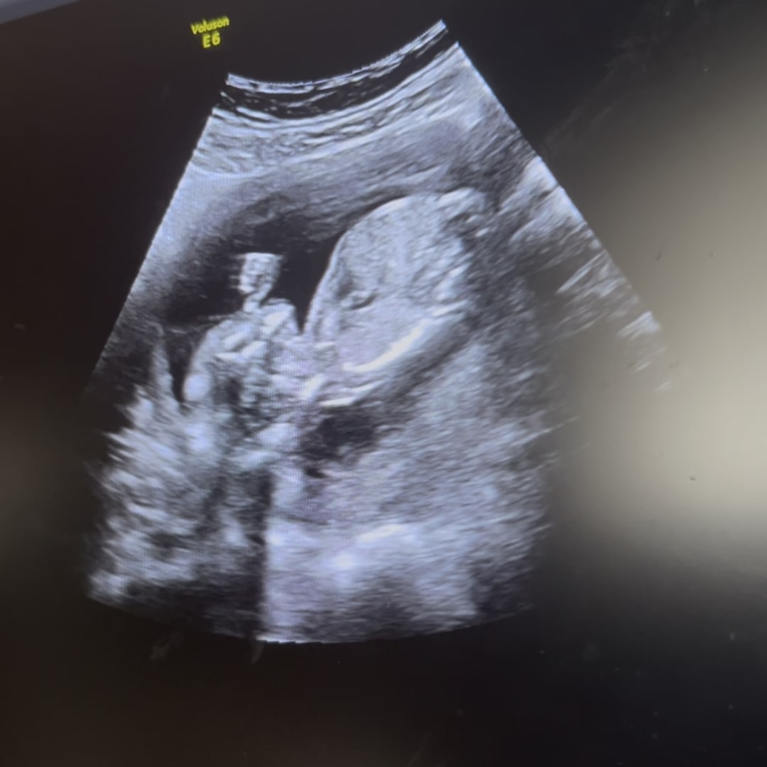 Photo shared by Kara for their Babylist baby registry.