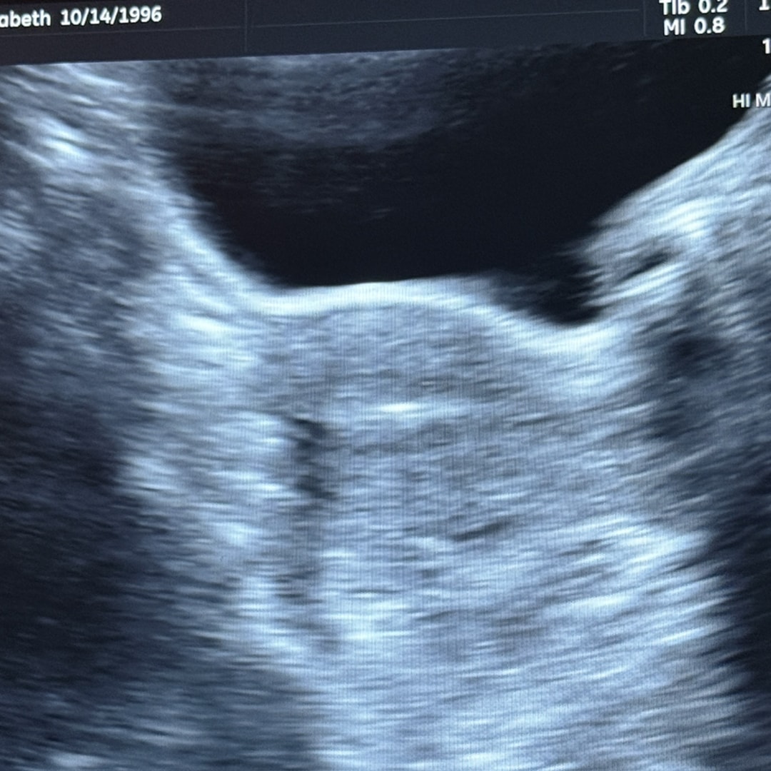 Photo shared by Liz for their Babylist baby registry.