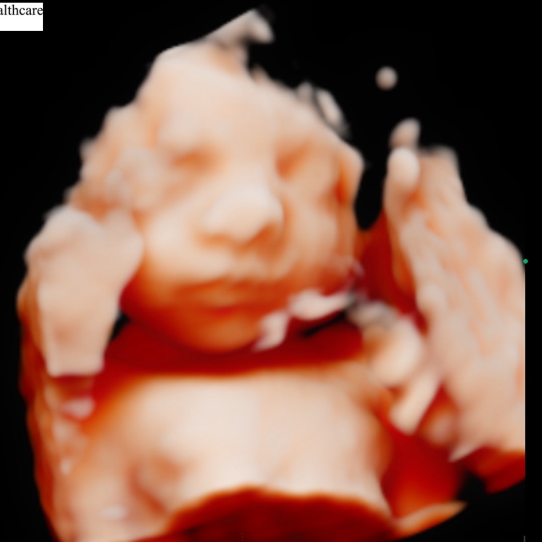 Photo shared by Jennifer for their Babylist baby registry.