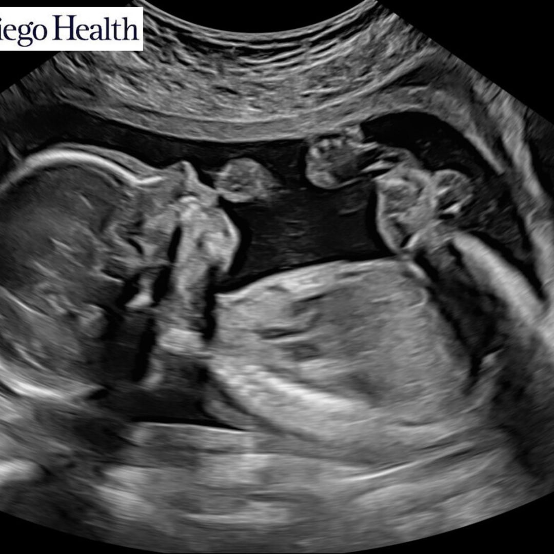 Photo shared by Kisha for their Babylist baby registry.