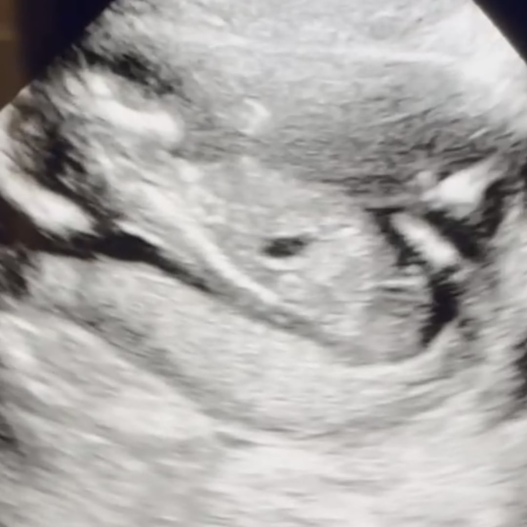 Photo shared by Emersyn for their Babylist baby registry.