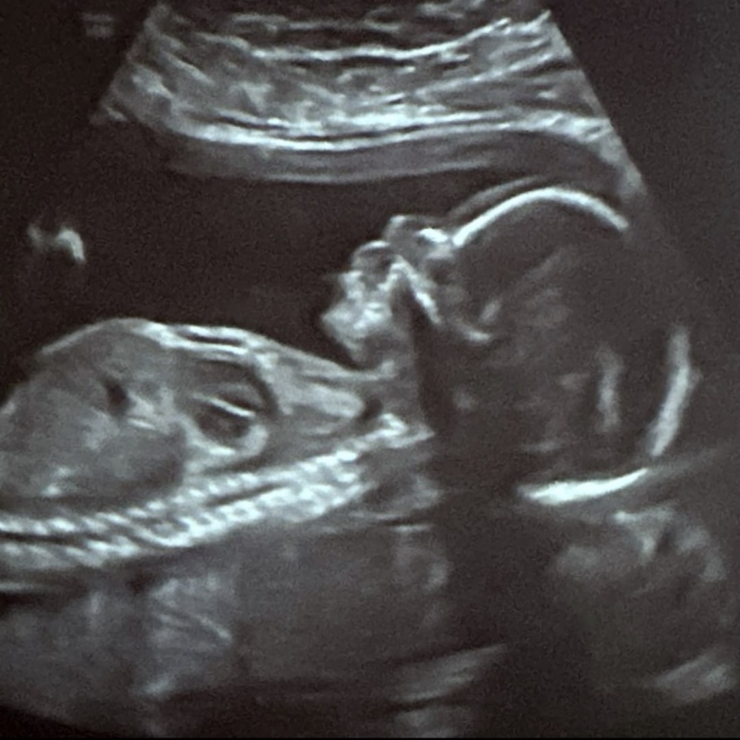 Photo shared by Brianne for their Babylist baby registry.