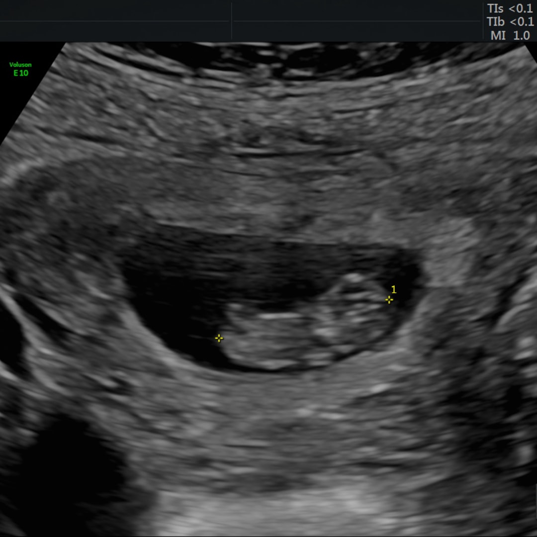 Photo shared by Megan for their Babylist baby registry.