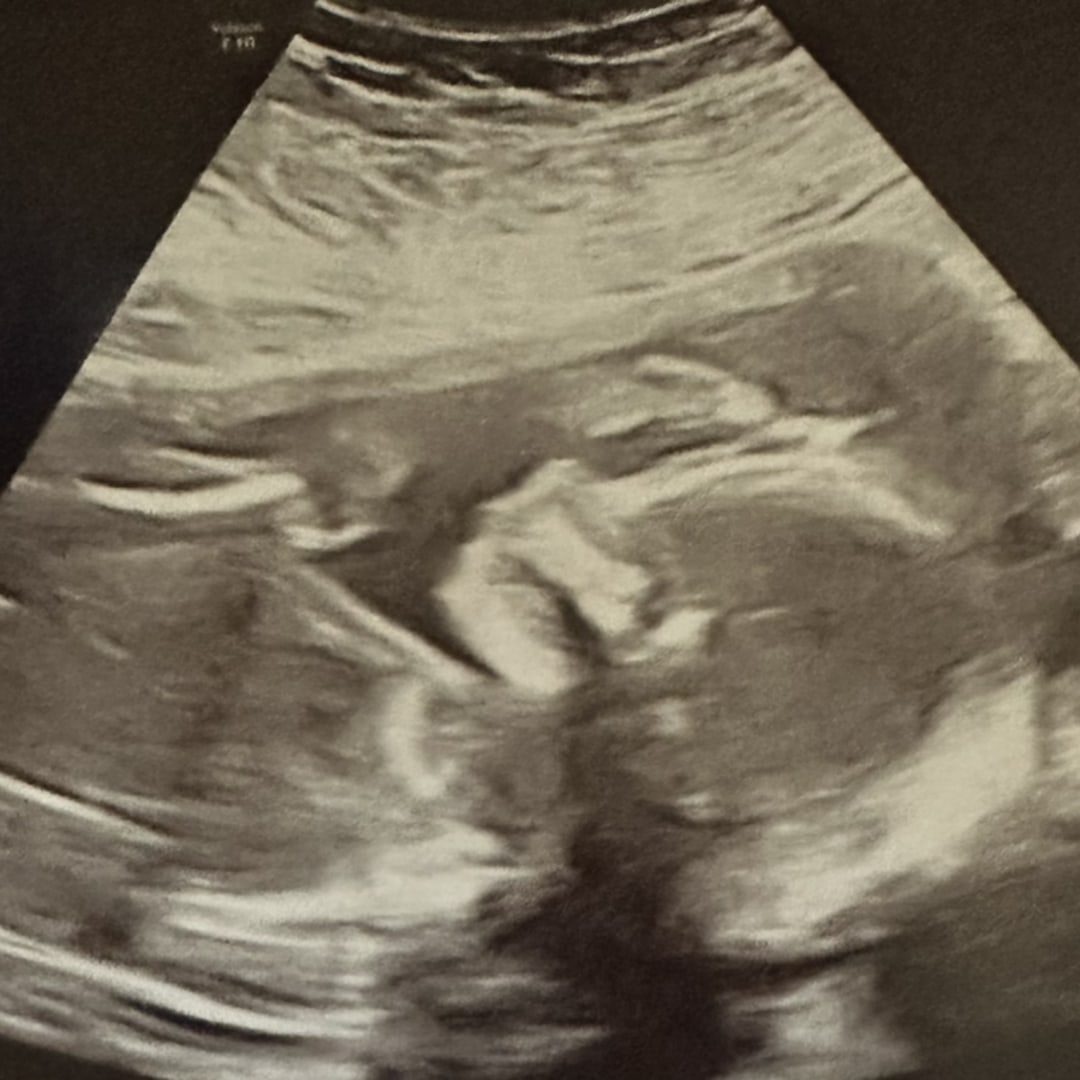Photo shared by Heather for their Babylist baby registry.