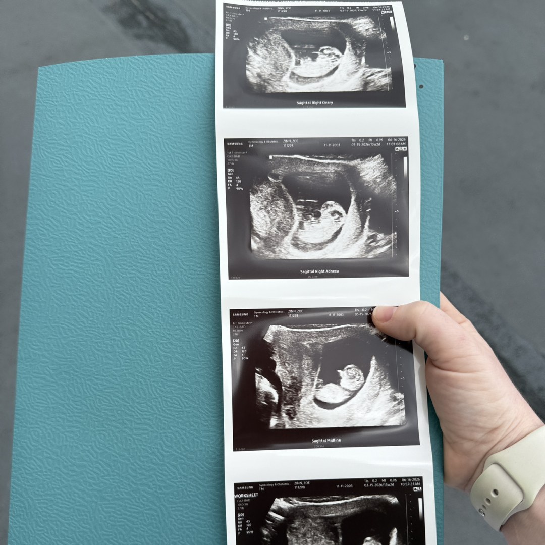 Photo shared by Zoe for their Babylist baby registry.