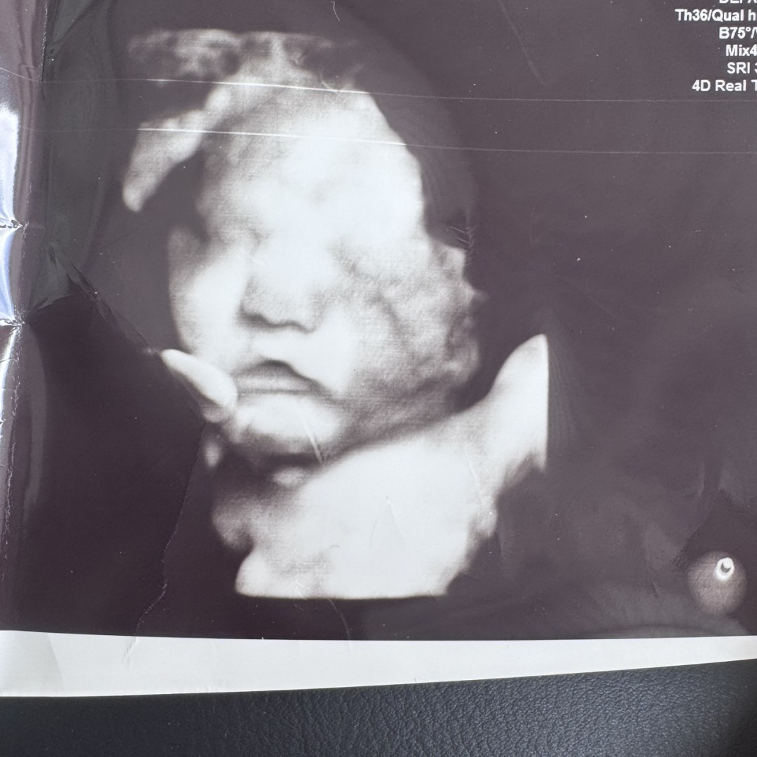 Photo shared by Jenifer for their Babylist baby registry.